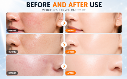 Zurelia Sun Guard SPF 90 Sunscreen